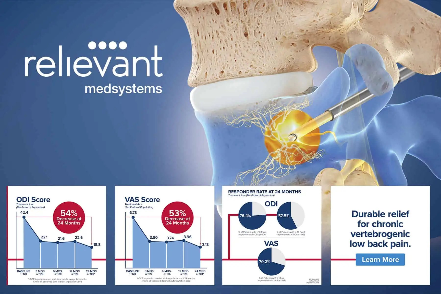 Relievant Medsystems design examples