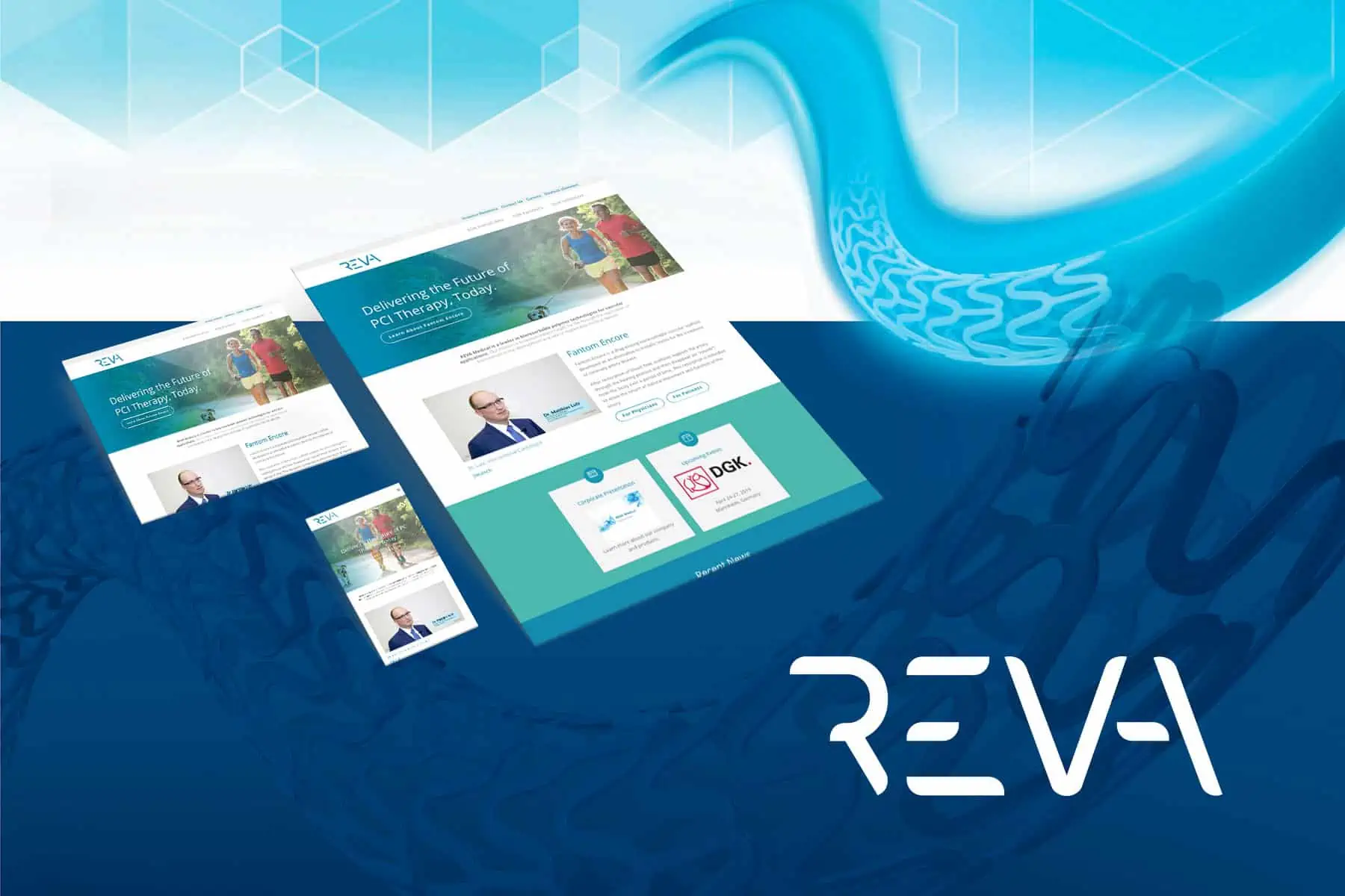 REVA Medical design examples